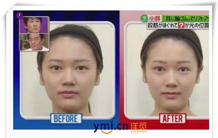日本妹子最新瘦脸秘诀：橡皮筋绑耳朵瘦脸法.jpg